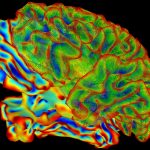 SumaLateral Whole Brain Image - NIH image gallery