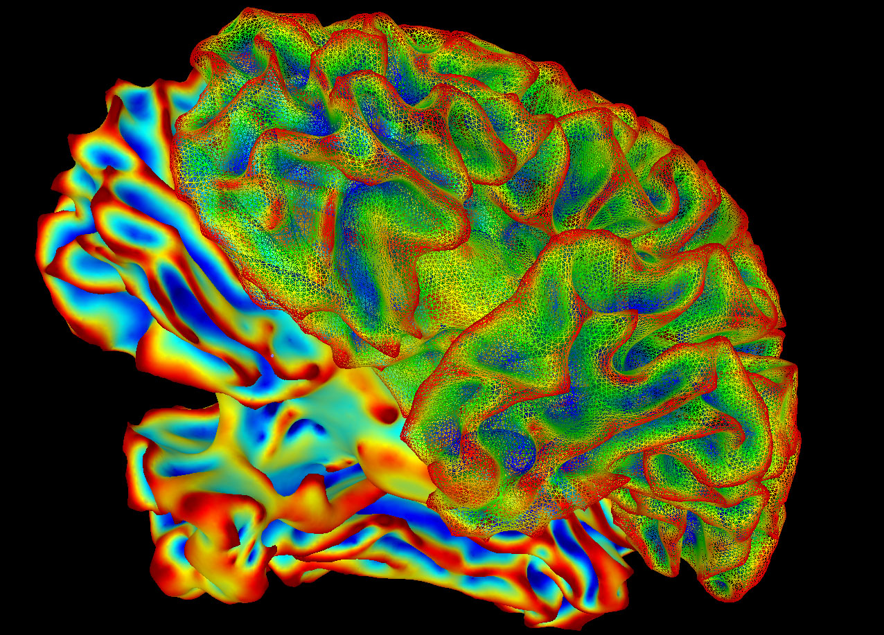 SumaLateral Whole Brain Image - NIH image gallery