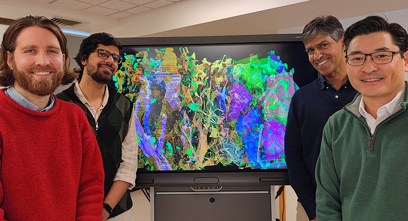 You are currently viewing RI-MUHC and McGill researchers make a breakthrough in understanding brain nanoarchitecture, using computer vision