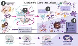 Read more about the article Offering a new hypothesis for the cause of Alzheimer’s disease