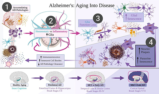 You are currently viewing Offering a new hypothesis for the cause of Alzheimer’s disease